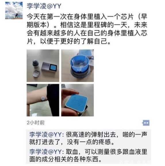 YY創始人李學淩自曝體內植入芯片